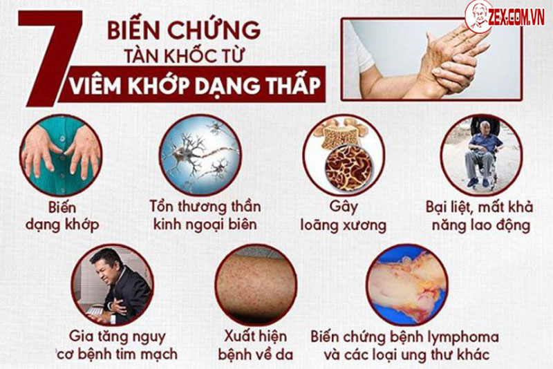 biến chứng của bệnh xương khớp