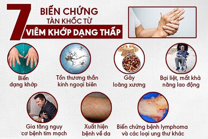 nguyên nhân đau nhức xương khớp