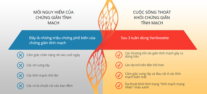 triệu chứng giãn tĩnh mạch - kem varikosette