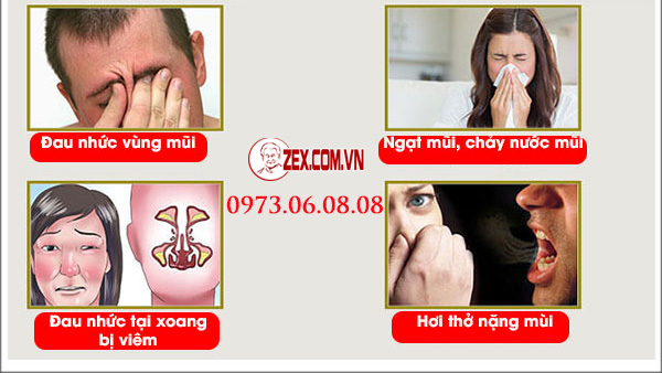 đối tượng sử dụng xoan rico